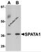 Spermatogenesis Associated 1 antibody, 6549, ProSci, Western Blot image 