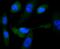 Glycogen Synthase 1 antibody, A03512-2, Boster Biological Technology, Immunocytochemistry image 