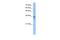 Solute Carrier Family 25 Member 16 antibody, A12105, Boster Biological Technology, Western Blot image 