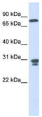Nitrilase Family Member 2 antibody, TA339349, Origene, Western Blot image 
