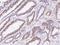 MutS Homolog 6 antibody, 101788-R021, Sino Biological, Immunohistochemistry frozen image 