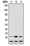 LIF Interleukin 6 Family Cytokine antibody, abx121636, Abbexa, Western Blot image 