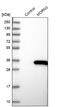 MORN Repeat Containing 3 antibody, NBP2-31007, Novus Biologicals, Western Blot image 