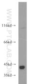 Survival Of Motor Neuron 2, Centromeric antibody, 20451-1-AP, Proteintech Group, Western Blot image 