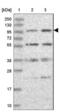 Kinesin Family Member 18A antibody, NBP1-85126, Novus Biologicals, Western Blot image 