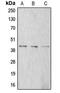 Actin Alpha 1, Skeletal Muscle antibody, MBS820915, MyBioSource, Western Blot image 