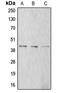 Actin Alpha 1, Skeletal Muscle antibody, MBS820915, MyBioSource, Western Blot image 