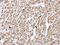 RELT TNF Receptor antibody, LS-C185610, Lifespan Biosciences, Immunohistochemistry paraffin image 