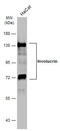 Involucrin antibody, GTX116012, GeneTex, Western Blot image 