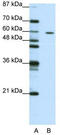 Zinc Finger Protein 382 antibody, TA345459, Origene, Western Blot image 