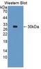 Parkin RBR E3 Ubiquitin Protein Ligase antibody, LS-C373741, Lifespan Biosciences, Western Blot image 