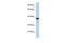 DMRT Like Family C2 antibody, PA5-41188, Invitrogen Antibodies, Western Blot image 