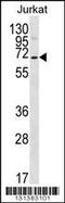 Prosaposin Like 1 (Gene/Pseudogene) antibody, 56-400, ProSci, Western Blot image 