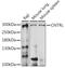 Centriolin antibody, GTX66337, GeneTex, Western Blot image 