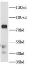 Protein Kinase C Alpha antibody, FNab10082, FineTest, Western Blot image 
