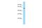 Sulfide Quinone Oxidoreductase antibody, A11155, Boster Biological Technology, Western Blot image 