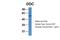 Dopa Decarboxylase antibody, ARP41425_T100, Aviva Systems Biology, Western Blot image 