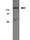 Protein Tyrosine Kinase 2 Beta antibody, GTX16672, GeneTex, Western Blot image 