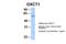 3-Oxoacid CoA-Transferase 1 antibody, 30-414, ProSci, Western Blot image 