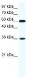 Forkhead Box F1 antibody, TA329386, Origene, Western Blot image 
