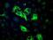 Branched Chain Keto Acid Dehydrogenase Kinase antibody, NBP1-47664, Novus Biologicals, Immunofluorescence image 
