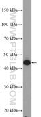 Keratin 34 antibody, 20449-1-AP, Proteintech Group, Western Blot image 