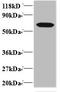 TNF Receptor Superfamily Member 11a antibody, A51841-100, Epigentek, Western Blot image 
