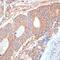 Enolase 1 antibody, GTX55604, GeneTex, Immunohistochemistry paraffin image 