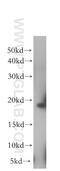 Eukaryotic Translation Initiation Factor 1A X-Linked antibody, 11649-2-AP, Proteintech Group, Western Blot image 