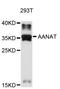 Aralkylamine N-Acetyltransferase antibody, A11850, ABclonal Technology, Western Blot image 