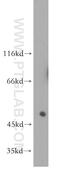 Leukocyte Immunoglobulin Like Receptor A2 antibody, 11461-1-AP, Proteintech Group, Western Blot image 