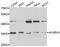 AlkB Homolog 3, Alpha-Ketoglutaratedependent Dioxygenase antibody, TA332927, Origene, Western Blot image 