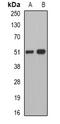 Pancreatic Lipase antibody, orb341065, Biorbyt, Western Blot image 