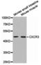 C-X-C Motif Chemokine Receptor 3 antibody, TA327450, Origene, Western Blot image 