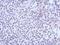Kelch Like Family Member 13 antibody, PA5-31658, Invitrogen Antibodies, Immunohistochemistry frozen image 