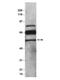 Serpin Family F Member 1 antibody, GTX14993, GeneTex, Western Blot image 