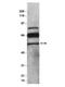 EPC1 antibody, GTX14993, GeneTex, Western Blot image 