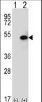 Sphingosine Kinase 1 antibody, LS-C161448, Lifespan Biosciences, Western Blot image 