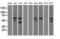 Checkpoint Kinase 2 antibody, LS-C114493, Lifespan Biosciences, Western Blot image 