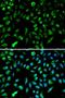 NME/NM23 Nucleoside Diphosphate Kinase 1 antibody, orb129706, Biorbyt, Immunocytochemistry image 