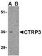 C1q And TNF Related 3 antibody, ADI-905-716-100, Enzo Life Sciences, Western Blot image 
