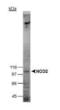 Nucleotide Binding Oligomerization Domain Containing 2 antibody, MA1-16611, Invitrogen Antibodies, Western Blot image 