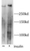 Raft1 antibody, FNab10006, FineTest, Western Blot image 