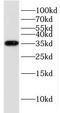 Potassium Voltage-Gated Channel Subfamily J Member 15 antibody, FNab04491, FineTest, Western Blot image 