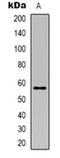 Coronin 1A antibody, orb318776, Biorbyt, Western Blot image 