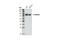 Catenin Beta 1 antibody, 9587P, Cell Signaling Technology, Western Blot image 