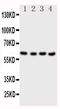 Cystathionine-Beta-Synthase antibody, PA1542, Boster Biological Technology, Western Blot image 