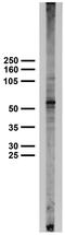 Serine/threonine-protein kinase PINK1, mitochondrial antibody, 73-061, Antibodies Incorporated, Western Blot image 