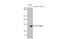 HIF1-alpha antibody, GTX628480, GeneTex, Western Blot image 