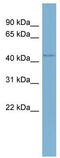 WD Repeat Containing, Antisense To TP73 antibody, TA345999, Origene, Western Blot image 